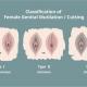 Types of FGM