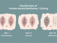 Types of FGM