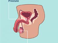 Prostate