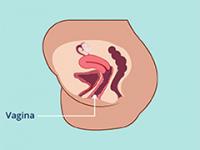 Vagina