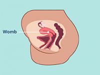 Womb