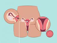 Womb